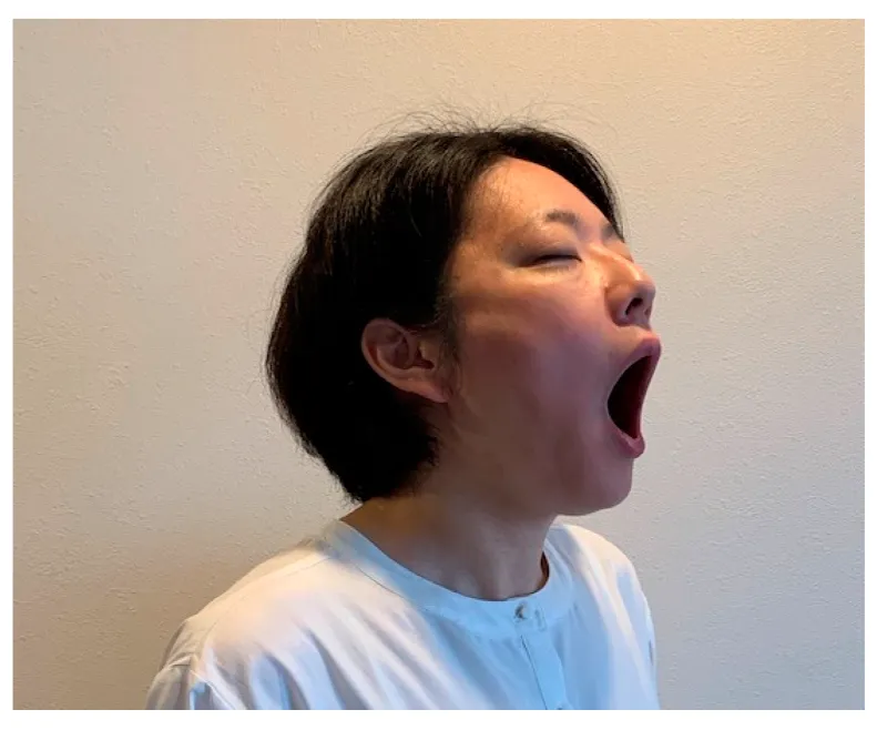 cách làm giảm mỡ nọng cằm